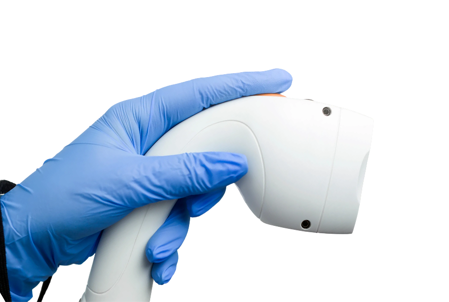 handle-laser-hair-removal 1