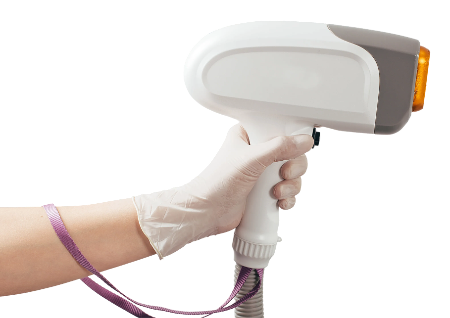 laser-hair-removal-epilator 1